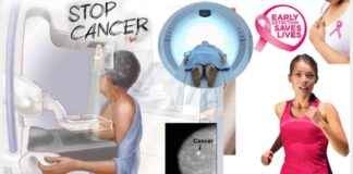 Breastfeeding vs Breast Cancer Risk: Impact on Women’s Health news-08082024-085441