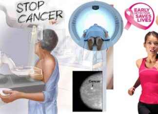 Breastfeeding vs Breast Cancer Risk: Impact on Women’s Health news-08082024-085441