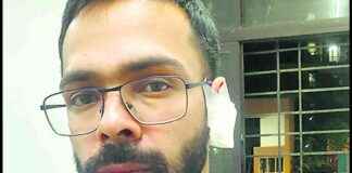 Friend’s Ear Bitten Off in Thane Anger Incident friends-ear-bitten-off-in-thane-anger-ncident